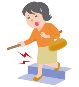 中高年女性の変形性股関節症