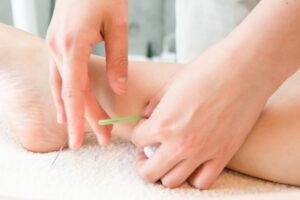 自律神経失調症に対する鍼灸施術