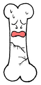 疲労骨折は骨の金属疲労