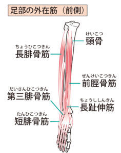 足首・くるぶしの痛み腓骨筋腱炎