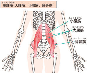 腸腰筋にも針治療