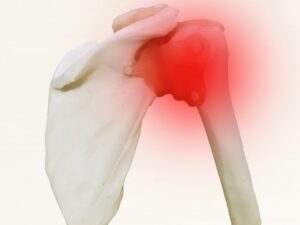 肩甲骨周辺の痛み、四十肩・五十肩