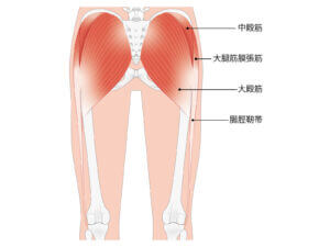 O脚となる大腿筋膜張筋