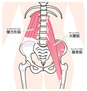 ぎっくり腰の原因となる腸腰筋