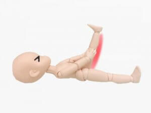 ハムストリングスの肉離れ