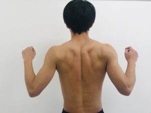 肩甲骨周辺の痛みには鍼灸を