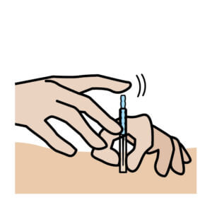 腱板損傷に対する鍼灸施術