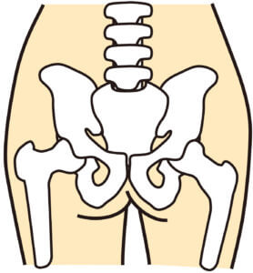 骨盤矯正