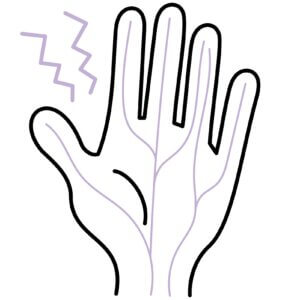 筋肉が正中神経を圧迫する