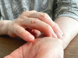 手首の痛み・TFCC損傷