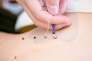 お灸を加えた「冷え取りコース」