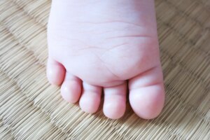 外反母趾や偏平足でもなりやすいモートン病