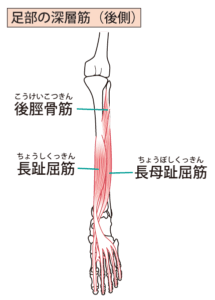 すねの内側の痛み、シンスプリント