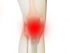 膝のお皿やお皿の上が痛むジャンパー膝