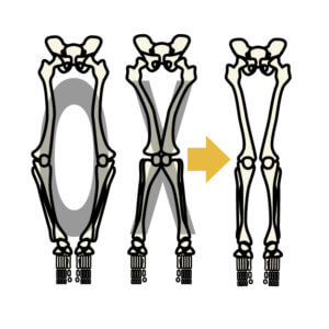 O脚・X脚にも鍼灸を