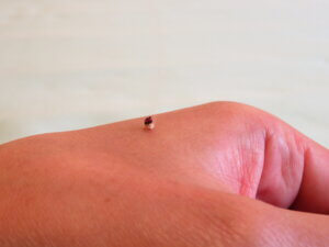 鍼灸師が使う艾（もぐさ）のお灸