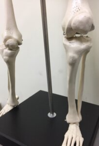 成長痛の太ももの痛み