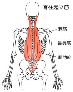 脊柱起立筋が張ると背中や腰が痛む