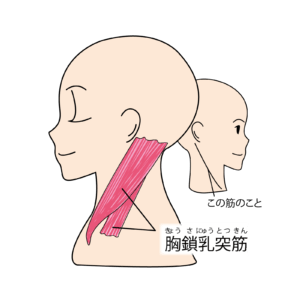 【首の横の痛み】胸鎖乳突筋に痛みを覚えたら【ゆうこん堂鍼灸院】
