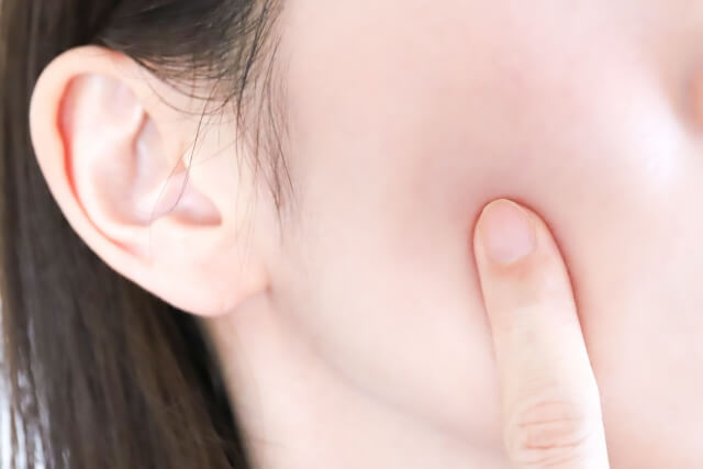 美肌効果もある鍼灸