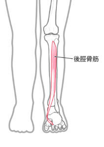 有痛性外脛骨障害への鍼治療