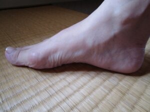 足裏のアーチ