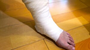 内反捻挫にも鍼灸を